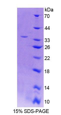 Carboxylesterase 1 (CES1), Recombinant Protein