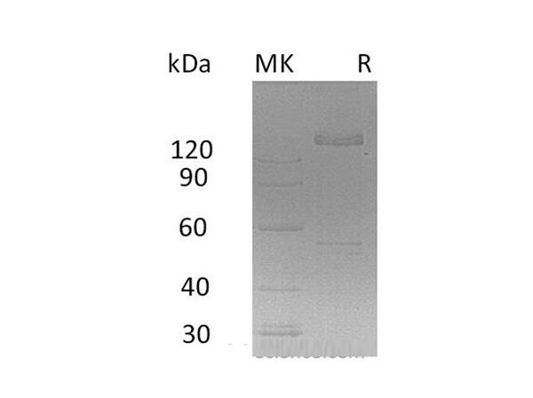 Jagged-1 (JAG1), Recombinant Protein