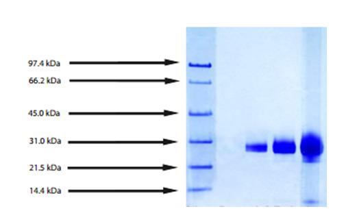 Azurocidin (AZU1), Protein