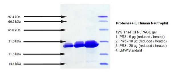 Proteinase 3 (PR3) (AGP7), Protein For Research Use | High Purity ...